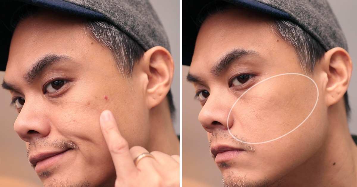 before and after pimple coverup